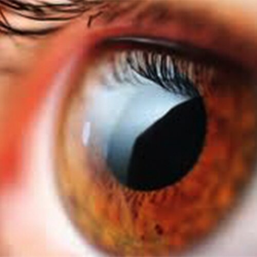 Smart Camera Contact Lens